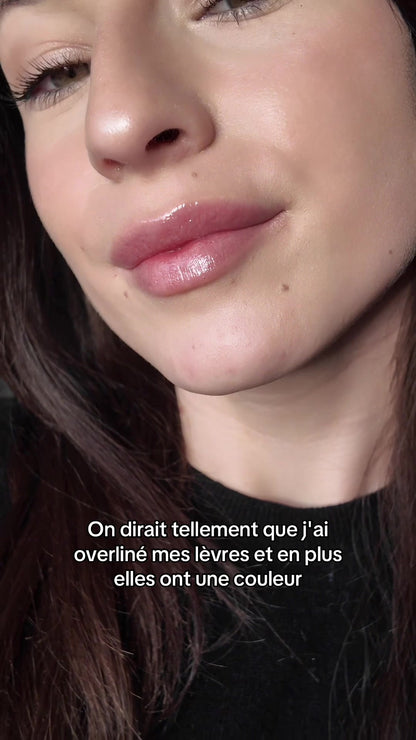 Des lèvres visiblement plus pulpeuses en 60 secondes.