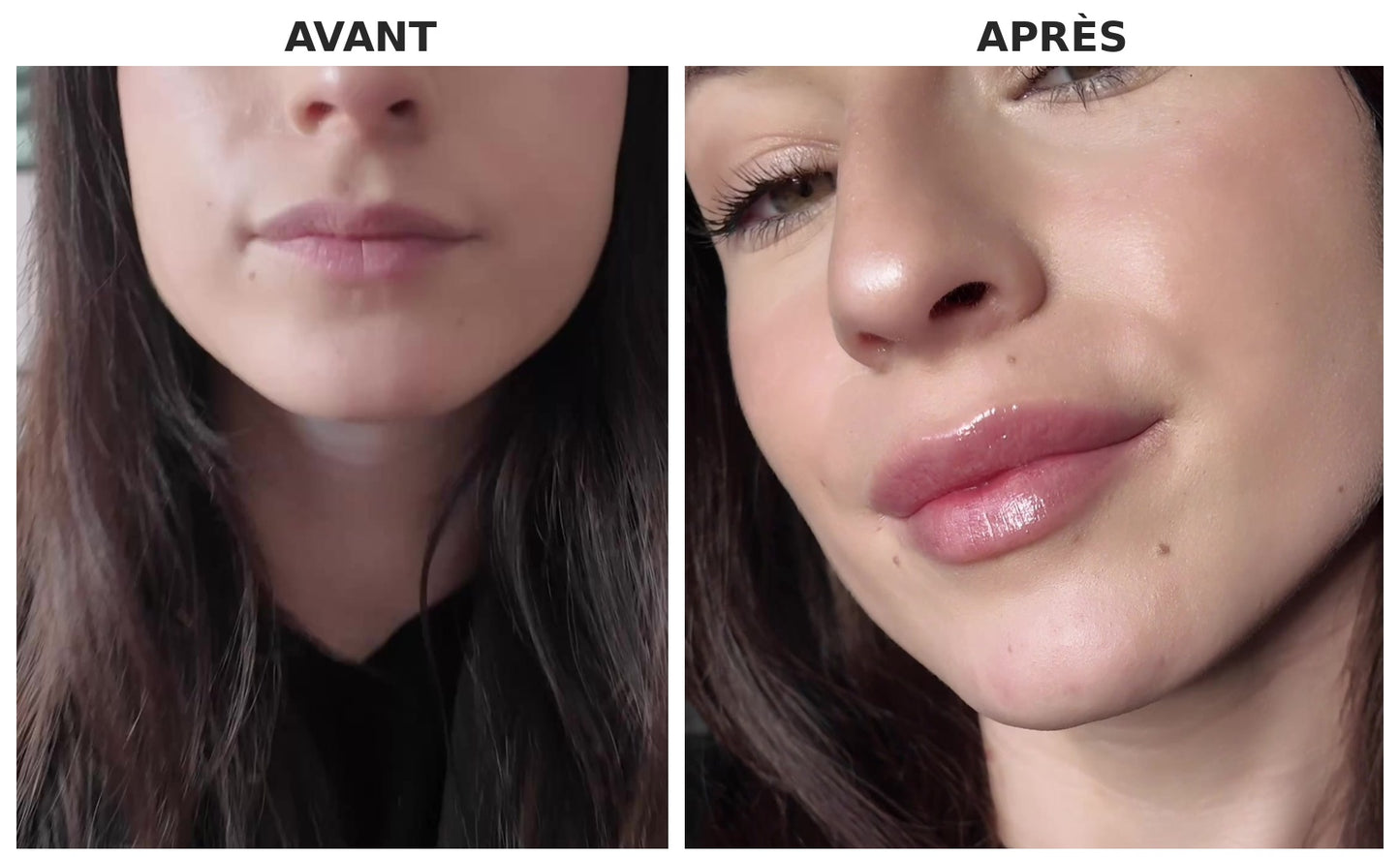 Des lèvres visiblement plus pulpeuses en 60 secondes.